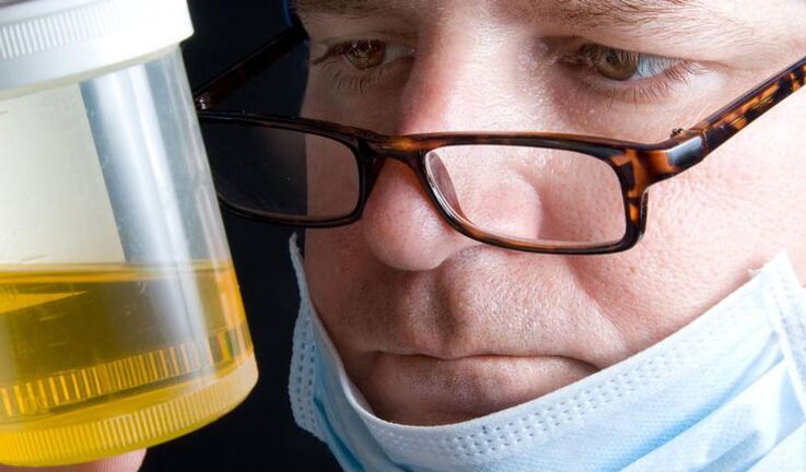 análise de orina para a prostatite crónica